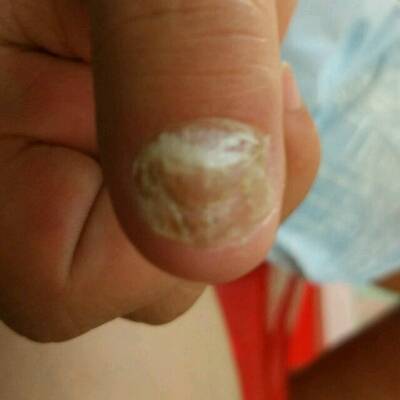 不知道怀孕做了指甲