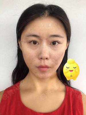 脸部麻木是怎么回事