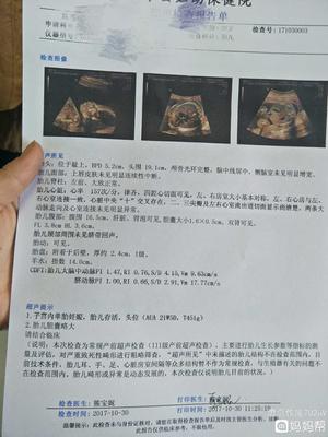 胆囊偏大是怎么回事