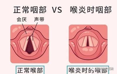 三岁小孩半夜咳嗽是什么原因