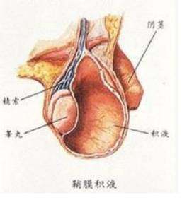 一侧睾丸疼痛是怎么回事
