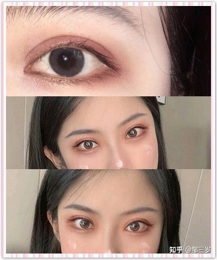 做双眼皮大概费用