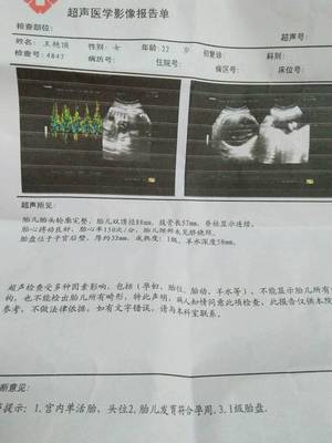怀孕7个月脐带绕颈一周怎么办