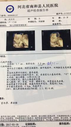 一个月小孩