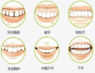 三十岁矫正牙齿要多久