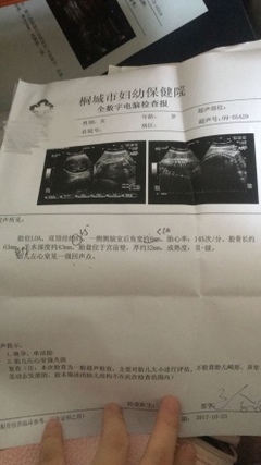 孕35周几个月