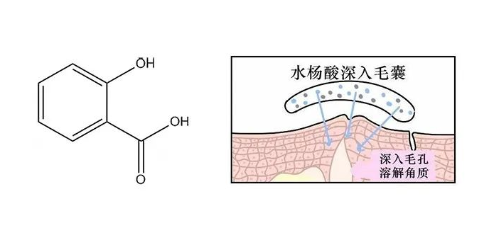 刷酸可以让痘痘快速成熟吗