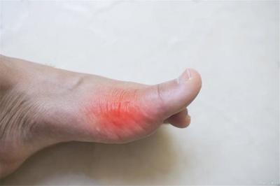 脚腕肿胀是怎么回事