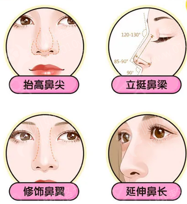 单眼皮双眼皮怎么遗传