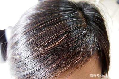 染发后怎么洗头
