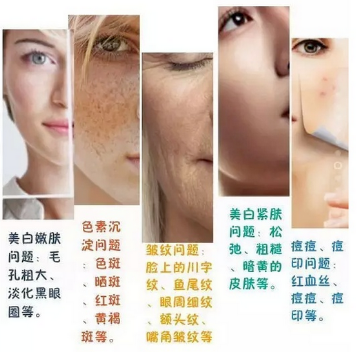 水光针的作用与功效