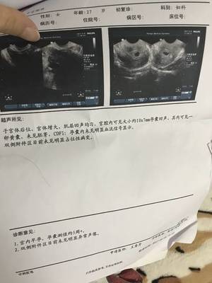 人流一次还能怀孕吗