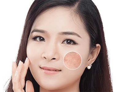 隔离霜可以直接补涂吗
