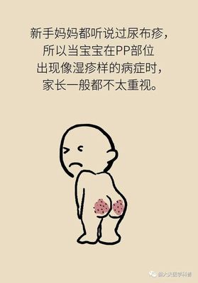 三个月宝宝有湿疹怎么办