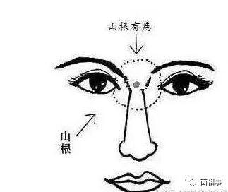 女人山根有痣面相图解