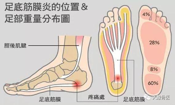 脚内侧疼是怎么回事