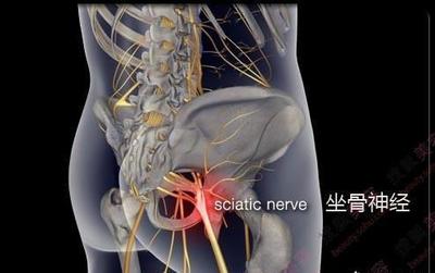 腰突怎么治疗