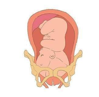 胎儿入盆的症状
