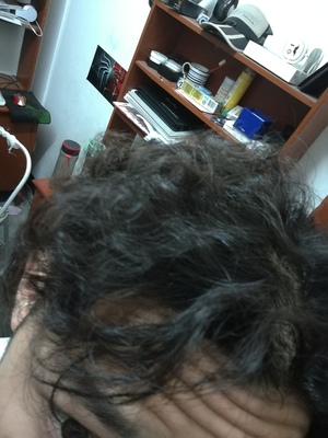卷发烫毁了怎么办