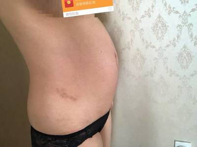 小肚子中间疼是怎么回事