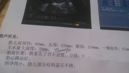 怀孕25周胎儿有多大