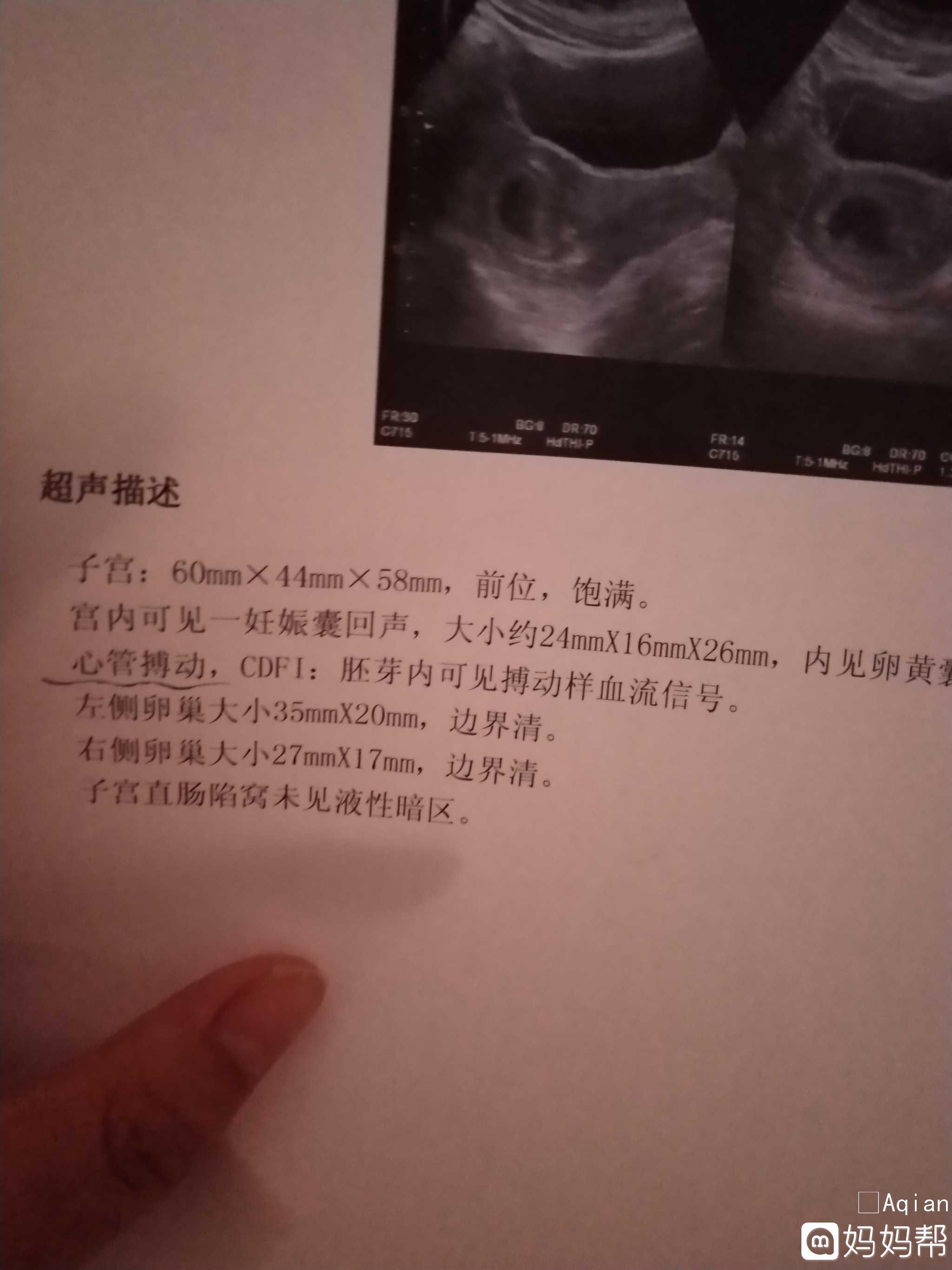 怀孕多久可以鉴定男女