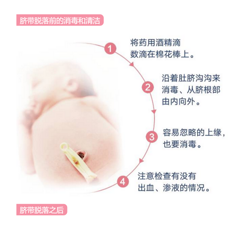 新生儿脐部护理流程