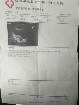 怀孕6周彩超图片