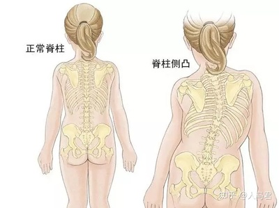 正常人的脊柱有多少个脊椎构成