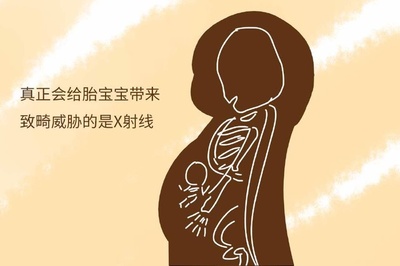 射线对胎儿的影响