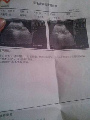 怎么测试男女宝宝最准