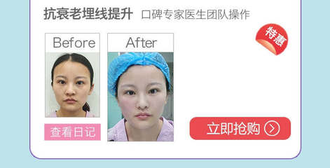 沈阳超声刀除皱