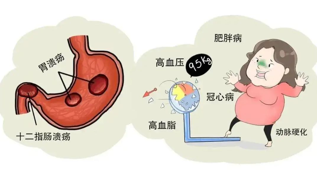 胃饥饿感是怎么回事