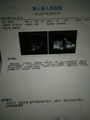 怀孕六个月做四维晚吗
