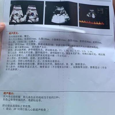 怀孕22周胎动频繁正常吗