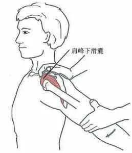左边肩膀疼是怎么回事