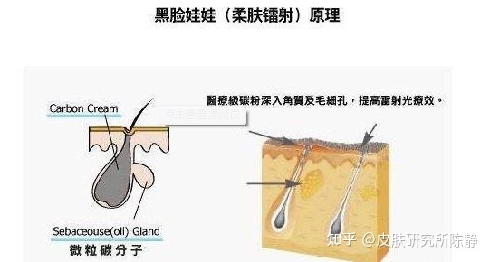 收缩毛孔的原理