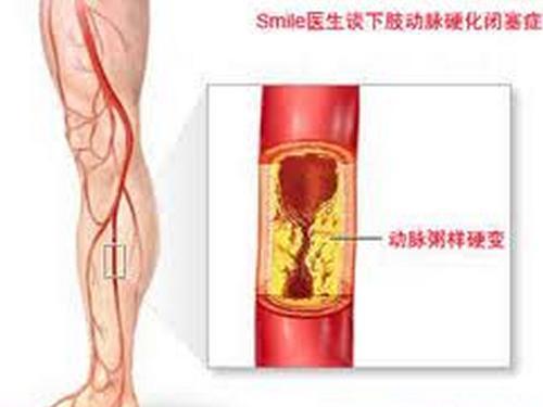 内膜增厚怎么治疗好