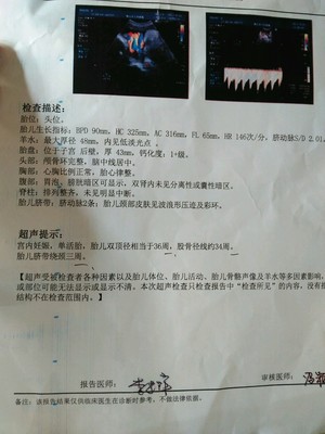 胎儿绕颈三周