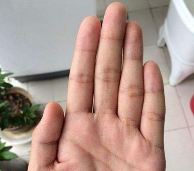 手小指短代表什么命运