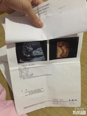 怀孕14周宝宝有多大