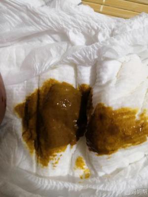 宝宝拉的粑粑黏糊糊的
