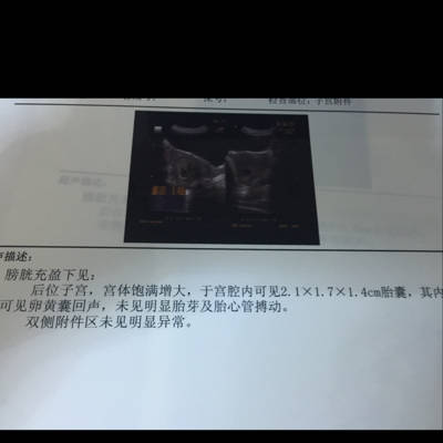 孕囊一周能长多少