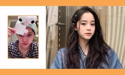 欧阳娜娜痘痘