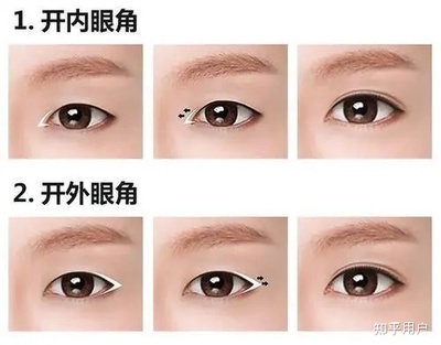割双眼皮眼型