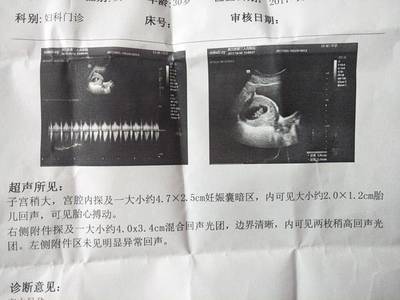 怀孕着床晚是什么意思