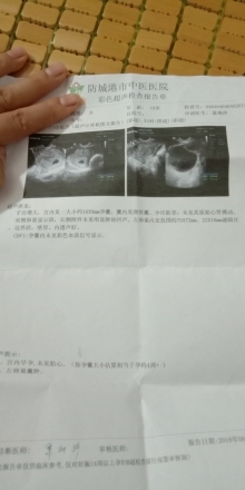 卵巢囊肿怀孕