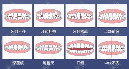 牙齿矫正好处
