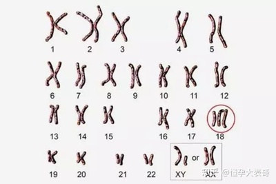 染色体会影响怀孕吗