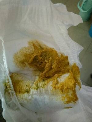 宝宝大便有酸臭味是怎么回事